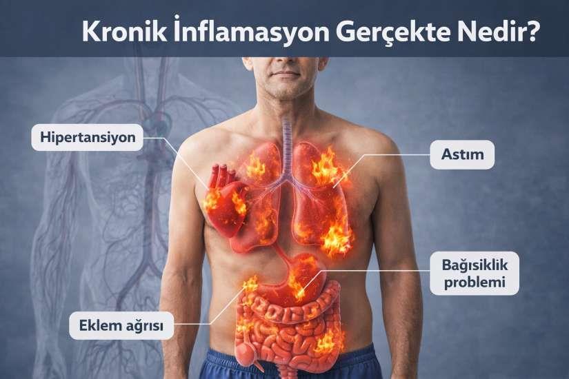Kronik İnflamasyon Nedir?