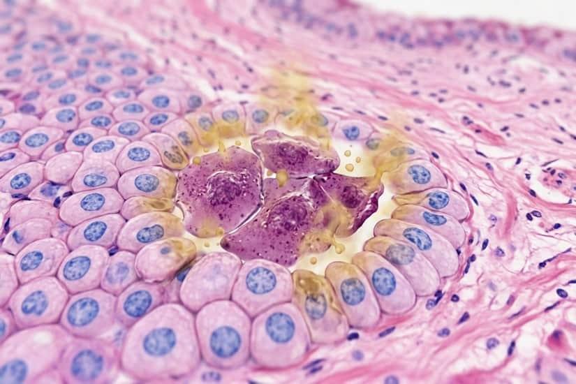 Zombi Hücreleri Nedir?